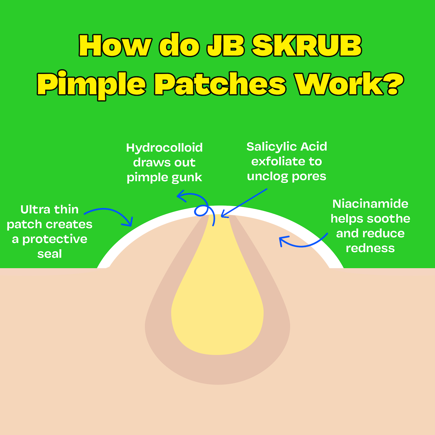 The Pimple Patches