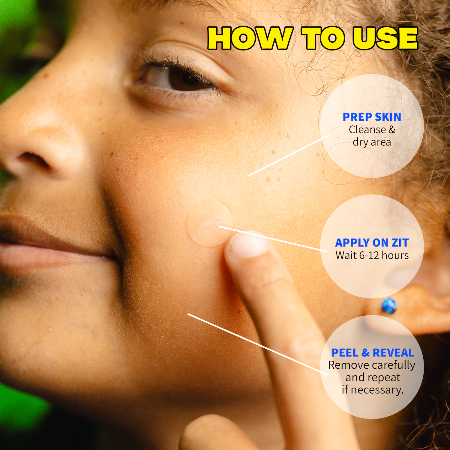 The Pimple Patches